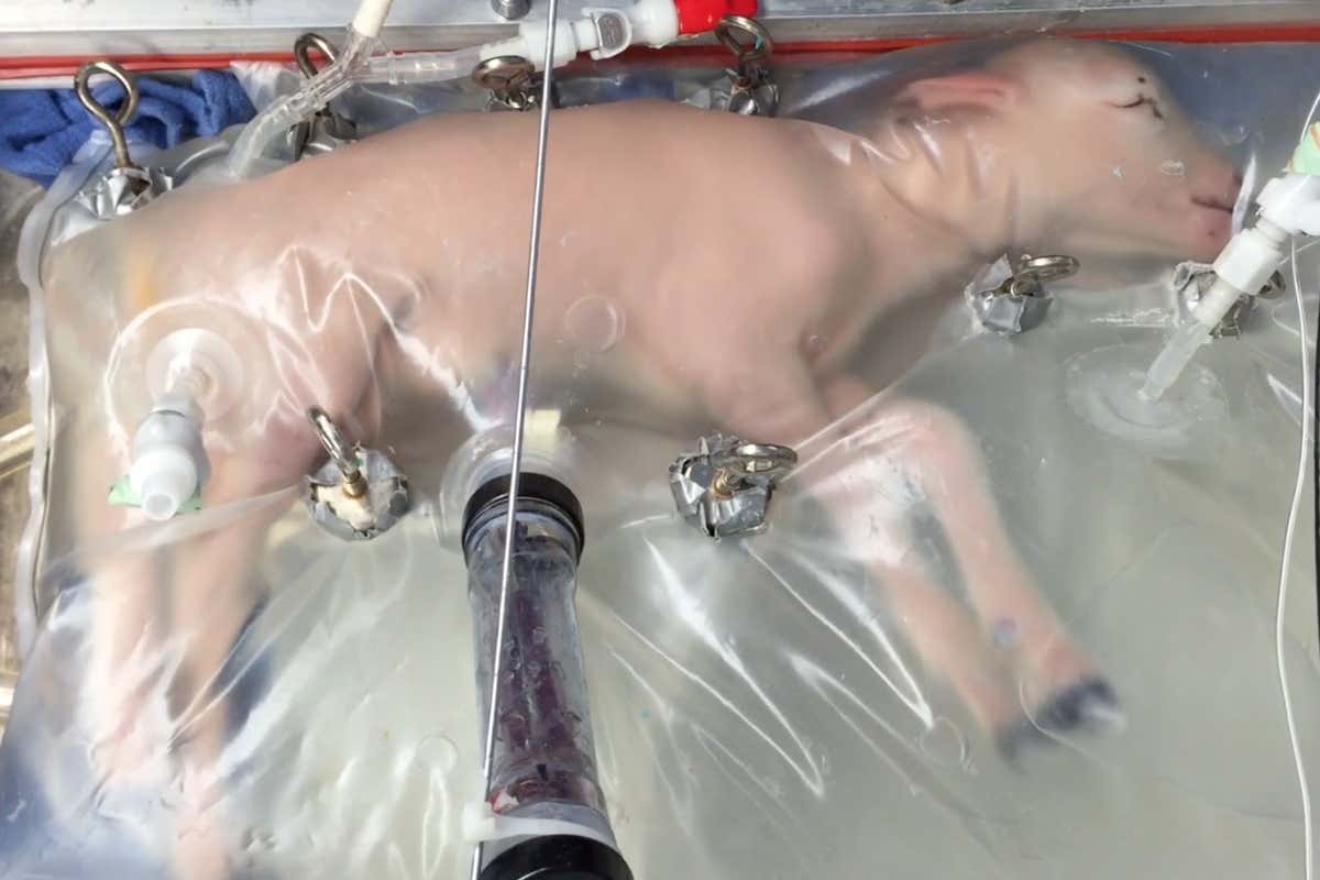 https://www.nature.com/articles/ncomms15112 Typical activity and appearance of a developmentally equivalent (107 day gestation) lamb fetus to a 23 ? 25 week gestation human infant during a run (day 5). SCREENGRAB - Supplementary Movie 1